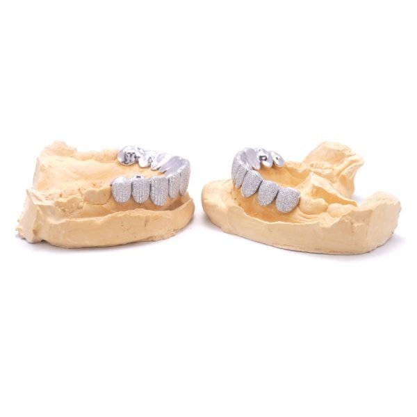 10 on 10 VVS Moissanite Prong Diamond Grillz - Image 8