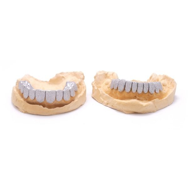 10 on 10 VVS Moissanite Prong Diamond Grillz - Image 6