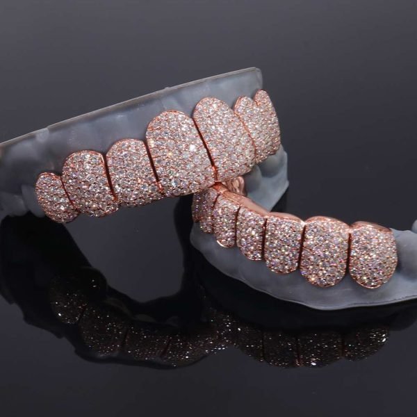 Rose Gold Perm Cut Custom Diamond Grillz 14K Gold - Image 4