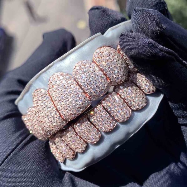 Rose Gold Perm Cut Custom Diamond Grillz 14K Gold - Image 5