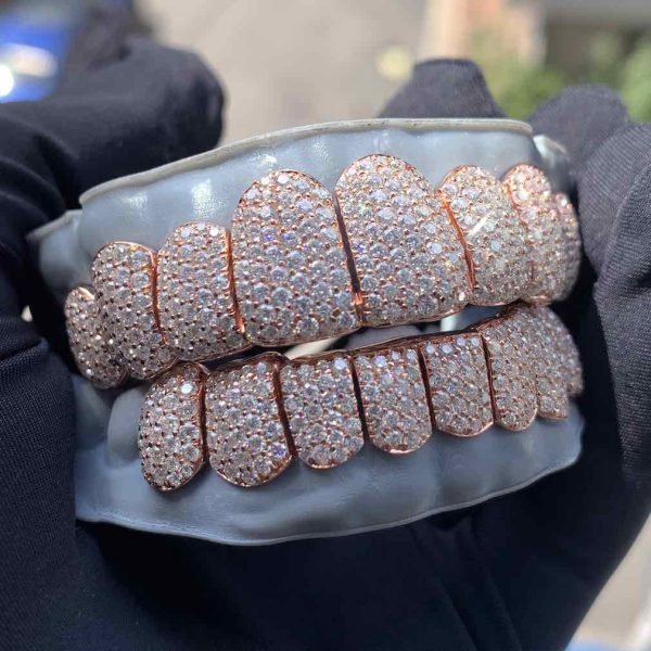 Rose Gold Perm Cut Custom Diamond Grillz 14K Gold - Image 6