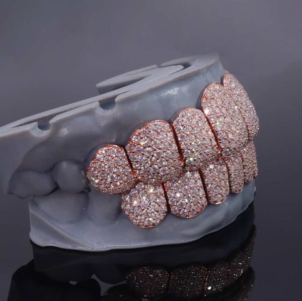 Rose Gold Perm Cut Custom Diamond Grillz 14K Gold - Image 3