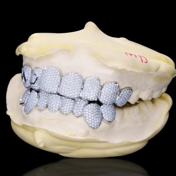 Custom Letter Moissanite Grillz - Image 5