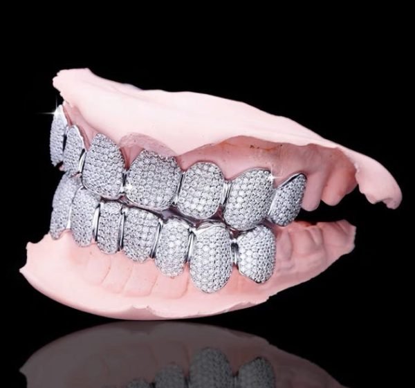 Custom Moissanite Cluster Grillz - Image 4