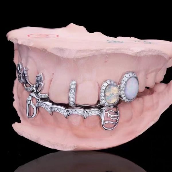 Custom Moissanite Opal Grillz - Image 3