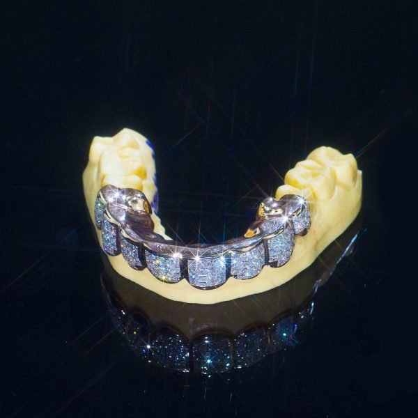 8 on 8 VVS Baguette Moissanite Diamond Grillz - Image 6