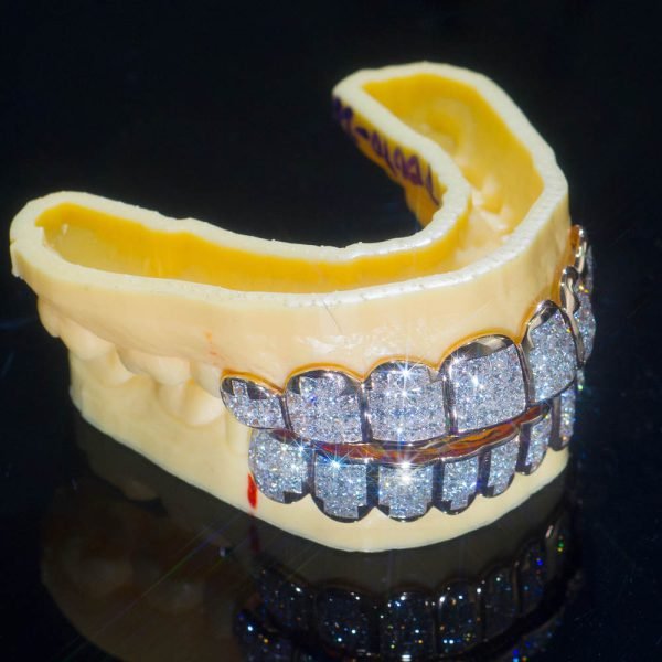 8 on 8 VVS Baguette Moissanite Diamond Grillz - Image 8